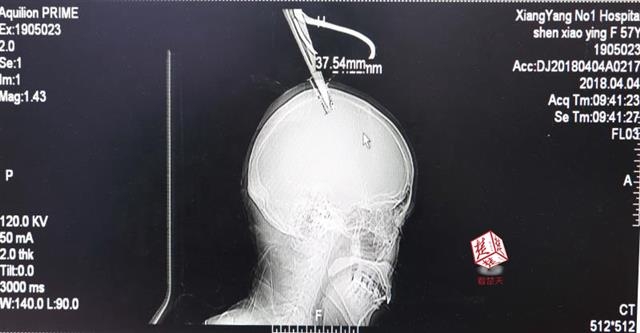 扫码加微信上门服务 _ 化肥复合肥,化肥扫二维码能证明是真的吗